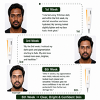 Pigmenatation Correction Gel